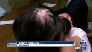 Hair Loss from Pesticides